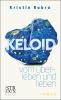 Keloid - 