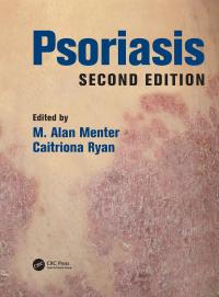 Psoriasis - 